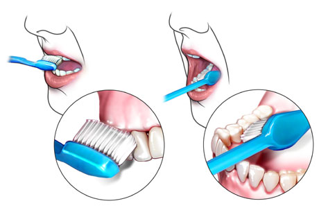 Oral hygiene2