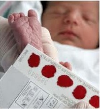 نمونه گیری خون پاشنه پای نوزادان